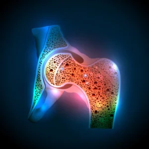 Osteopenia and osteoporosis