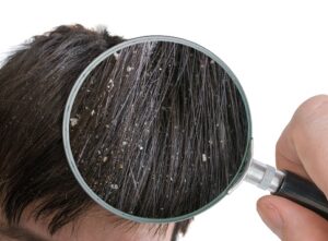 How to Stop Hair Loss and Regrow Hair Naturally for male and female